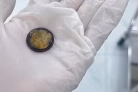 Bé 4 tuổi nuốt phải pin cúc áo suýt thủng thực quản 