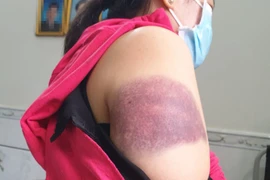 Bảo vệ dân phố đánh phụ nữ ở TP.HCM bị đề xuất cho thôi việc 