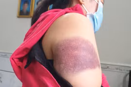 Bảo vệ dân phố đánh phụ nữ ở TP.HCM bị đề xuất cho thôi việc 