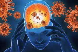 Tưởng đột quỵ, không ngờ viêm não tự miễn thể hiếm gặp