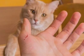 Nhiều người nhập viện vì mèo cào, cách sơ cứu vết thương