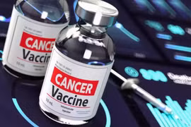 Vắc xin chống ung thư của Nga được phát triển thế nào?