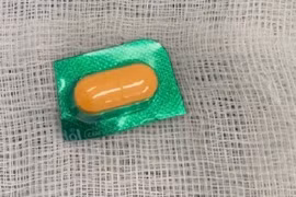 Người đàn ông sơ suất nuốt viên thuốc còn nguyên vỏ sắc nhọn 