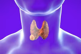 Lạm dụng mổ u tuyến giáp cẩn thận biến chứng nguy hiểm