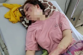 Cô gái tố bị bạn trai đánh, lột quần áo vì song ca với người khác