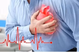 Bác sĩ chỉ rõ dấu hiệu nhận biết suy tim cấp