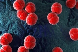 Bé trai nguy kịch do não mô cầu, cách phòng bệnh hiệu quả