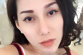 Ca sĩ Ivy Trần bị nổ túi ngực trên máy bay giờ ra sao?