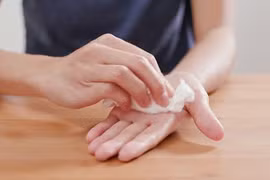  Ra mồ hôi tay, coi chừng dấu hiệu bệnh lý