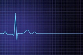 “Hồi sinh tim phổi qua điện thoại”, cứu sống nữ bệnh nhân ngưng tim