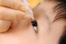 Đau mắt đỏ gia tăng… cẩn thận sẹo giác mạc, mất thị lực