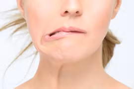 Trời lạnh coi chừng liệt mặt, méo miệng, phòng bệnh thế nào?