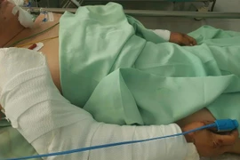 Người phụ nữ bị chó pitbull cắn đứt tai, chấn thương nguy kịch