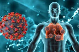 5 hiểu lầm thường gặp trong ung thư phổi