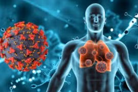 5 hiểu lầm thường gặp trong ung thư phổi