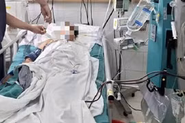 Uống thuốc nam không rõ nguồn gốc, người phụ nữ suy gan cấp