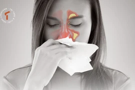 [LONGFORM]: Khổ vì viêm xoang mùa lạnh… bác sĩ mách cách phòng ngừa