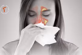 [LONGFORM]: Khổ vì viêm xoang mùa lạnh… bác sĩ mách cách phòng ngừa