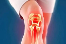 Bệnh nhân viêm khớp có “siêu năng lực” dự đoán thời tiết?