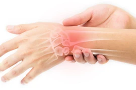 Căn bệnh khiến người phụ nữ đau nhức, tê bì tay suốt 1 năm