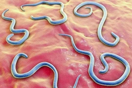 Gắp hơn 100 con giun đũa trong ruột bé trai 2 tuổi