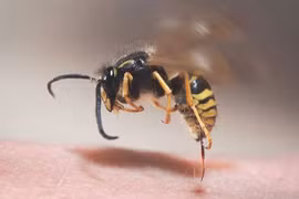 Nam bệnh nhân sốc phản vệ, ngưng tim do ong đốt