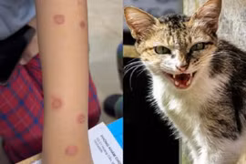 Cả gia đình nhiễm nấm da lây từ mèo hoang, bác sĩ cảnh báo