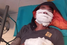 Điện thoại sạc qua đêm phát nổ khiến hai người bỏng nặng