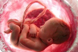 Sản phụ cạn ối sinh non: Ối cạn, cách nào dưỡng, giữ thai?