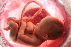 Sản phụ cạn ối sinh non: Ối cạn, cách nào dưỡng, giữ thai?