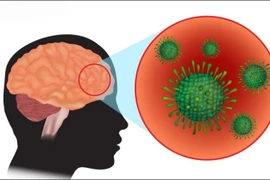Bé 6 tháng tuổi mắc não mô cầu, dấu hiệu cảnh báo bệnh