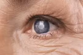 Biến chứng mắt ở người bệnh đái tháo đường dễ gây mù lòa