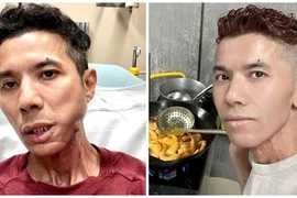 Cuộc sống khó khăn, bệnh tật đau đớn của Kasim Hoàng Vũ ở Mỹ