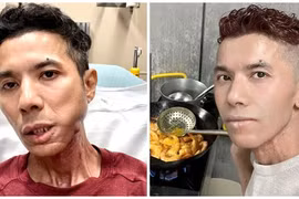 Cuộc sống khó khăn, bệnh tật đau đớn của Kasim Hoàng Vũ ở Mỹ