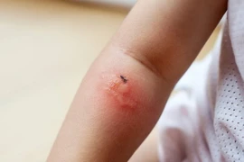 Những lưu ý khi dùng thuốc chống muỗi