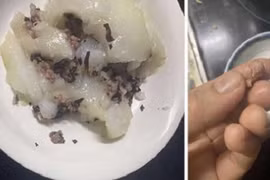 Vụ phát hiện hạch lợn trong bánh giò, chuyên gia cảnh báo