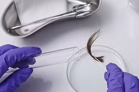 Con dâu hành động lạ, bố mẹ chồng xét nghiệm huyết thống với cháu