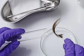 Con dâu hành động lạ, bố mẹ chồng xét nghiệm huyết thống với cháu