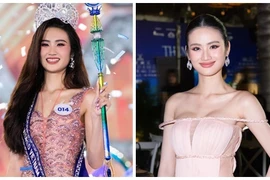Hoa hậu Ý Nhi công khai "dao kéo" vòng một