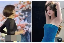 Ảnh Triệu Lộ Tư gầy “da bọc xương” trước tin đồn bị đột quỵ