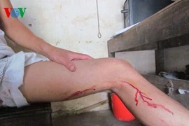 Phóng viên bị lợn rừng tấn công trọng thương