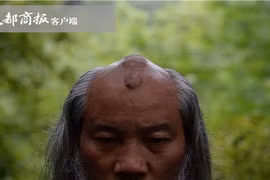 Cái đầu “mọc sừng” kỳ dị của chưởng môn phái Thanh Thành 