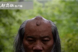 Cái đầu “mọc sừng” kỳ dị của chưởng môn phái Thanh Thành 