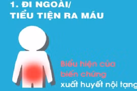 Dấu hiệu khi mắc sốt xuất huyết cần nhập viện ngay 