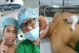 "Thảm họa mạng" Tùng Sơn dao kéo để trông bớt xấu?