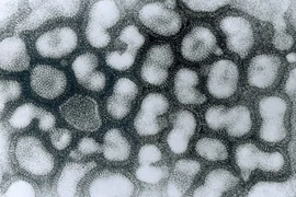 Ca cúm A H5 tại Khánh Hòa đã tử vong sau nhiều ngày thở máy