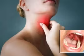 Cứu sống bệnh nhân tai biến… hóc xương gà