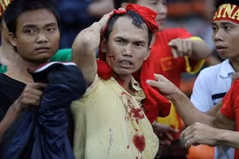 VFF khiếu nại về vụ CĐV Việt bị đánh ở Malaysia