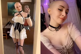 Cô gái bán ảnh kiếm tiền tỷ để trả phí điều trị ung thư