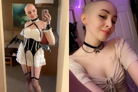 Cô gái bán ảnh kiếm tiền tỷ để trả phí điều trị ung thư